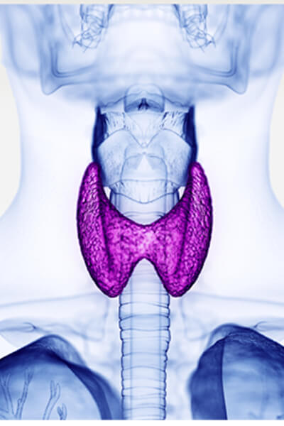 Thyroid Radiofrequency Ablation